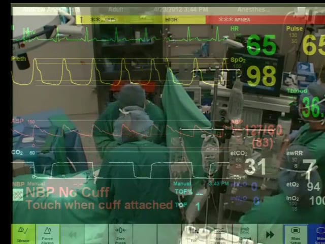 Nurse Anesthesia O.R. video thumbnail